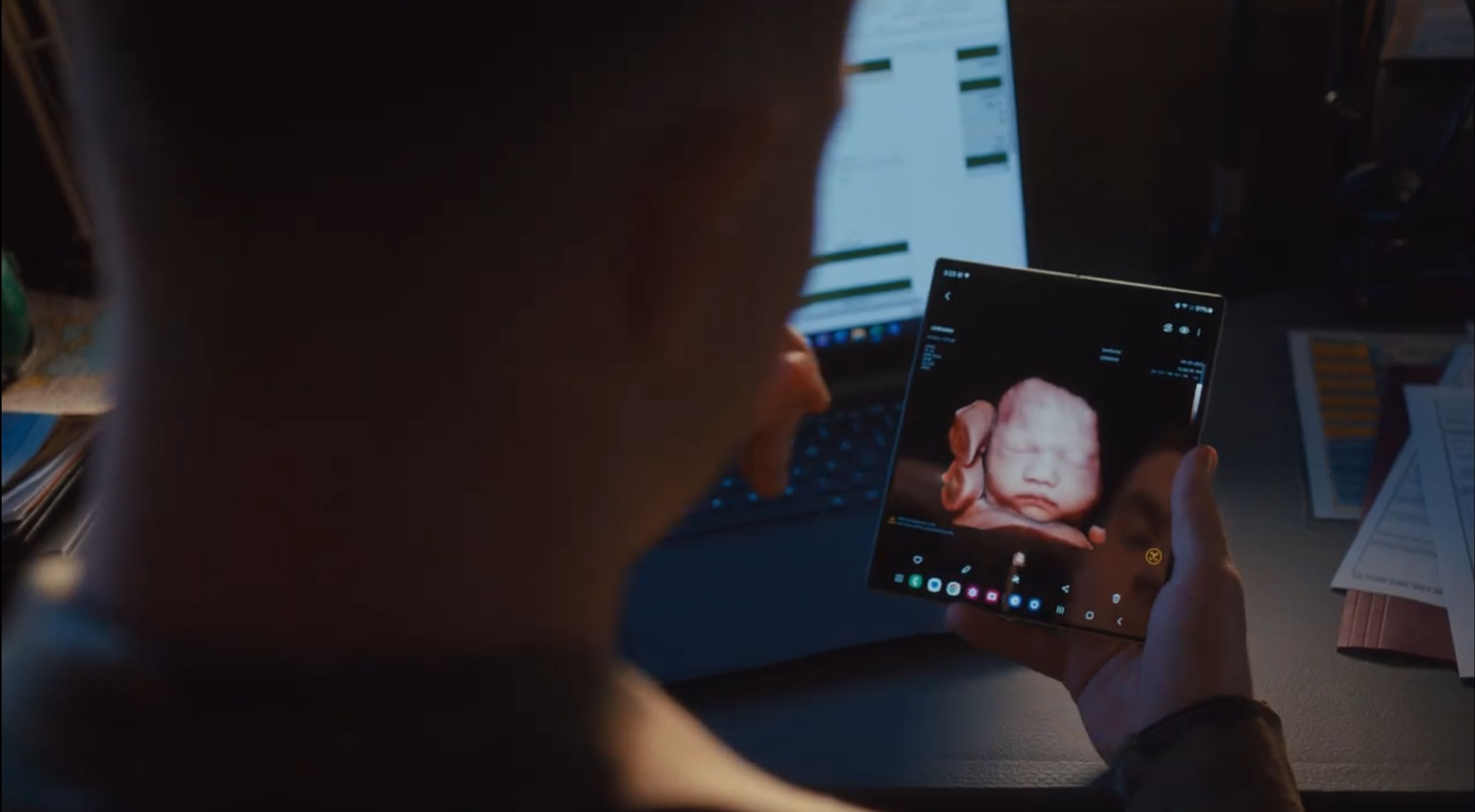 Z20 Women's Health Ultrasound | Samsung Healthcare